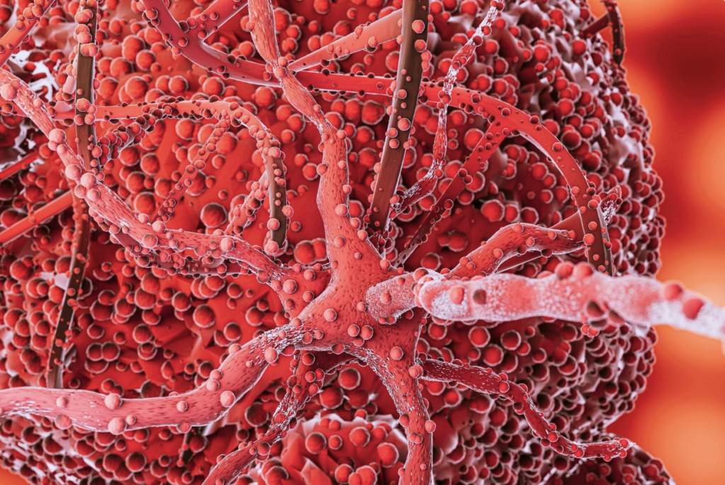 Detectan proteína clave que podría anticipar metástasis en cáncer de mama